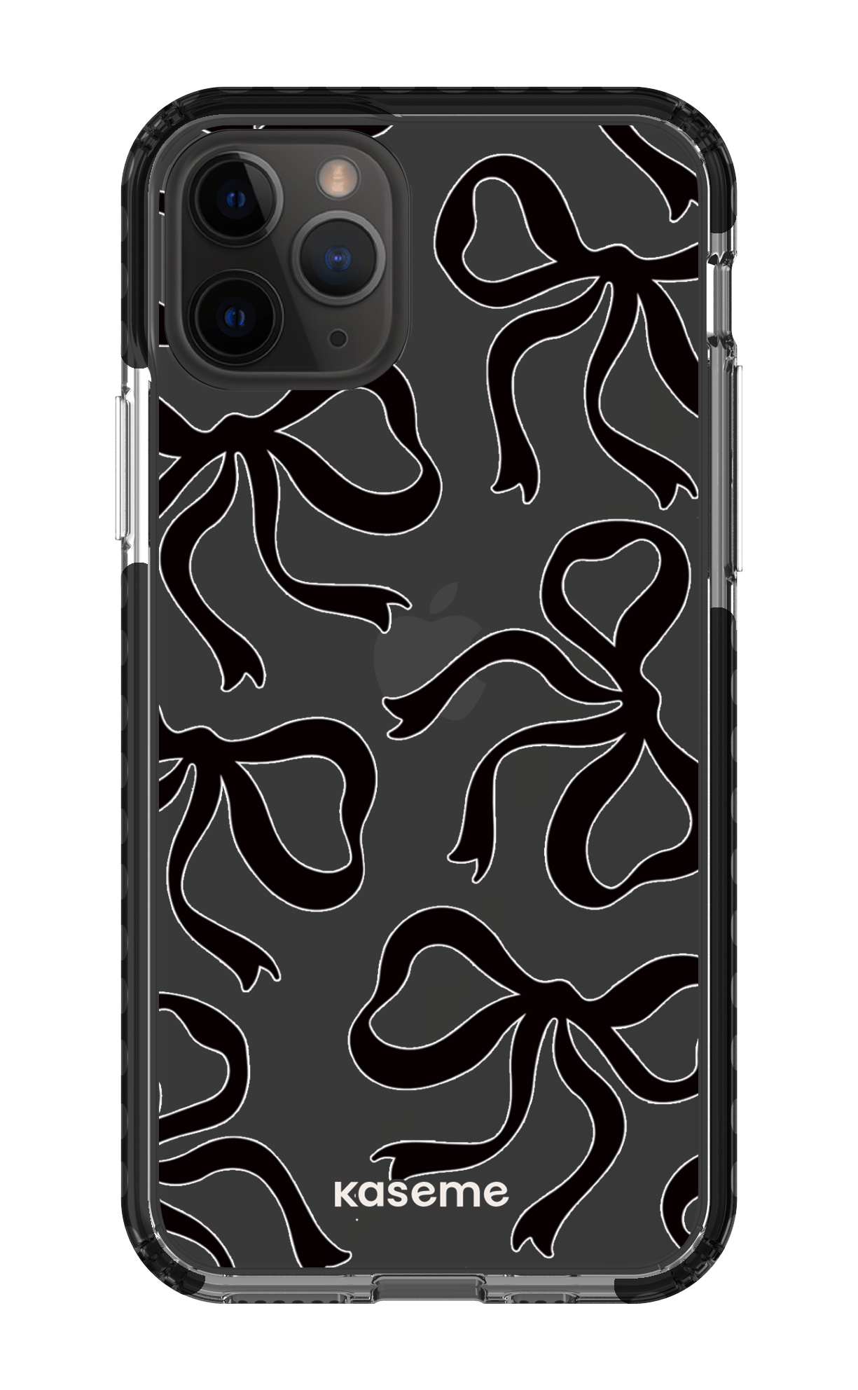 iPhone 11 Pro Clear Case - Black Lace Black Clear Case -