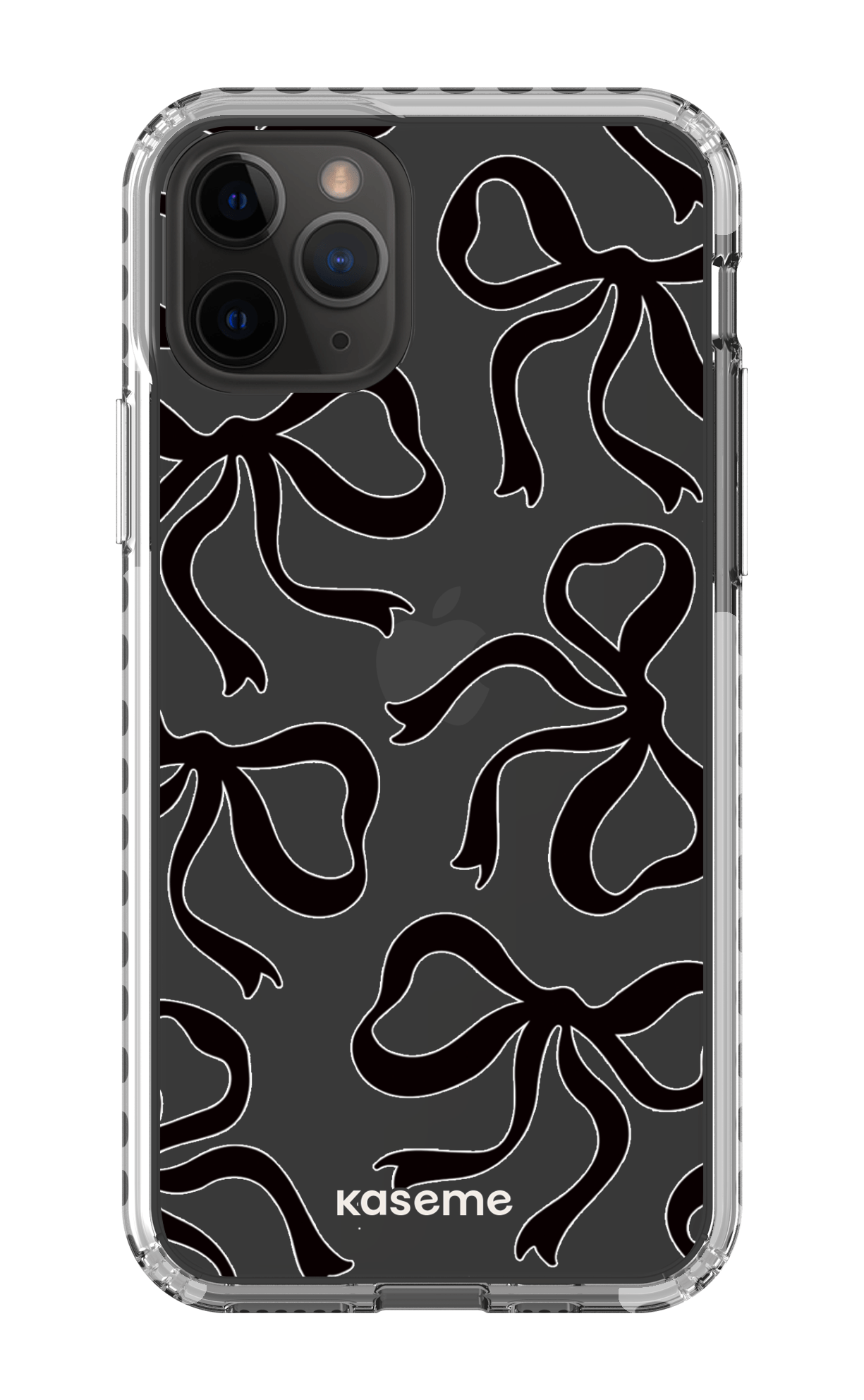 iPhone 11 Pro Clear Case - White Lace Black Clear Case -