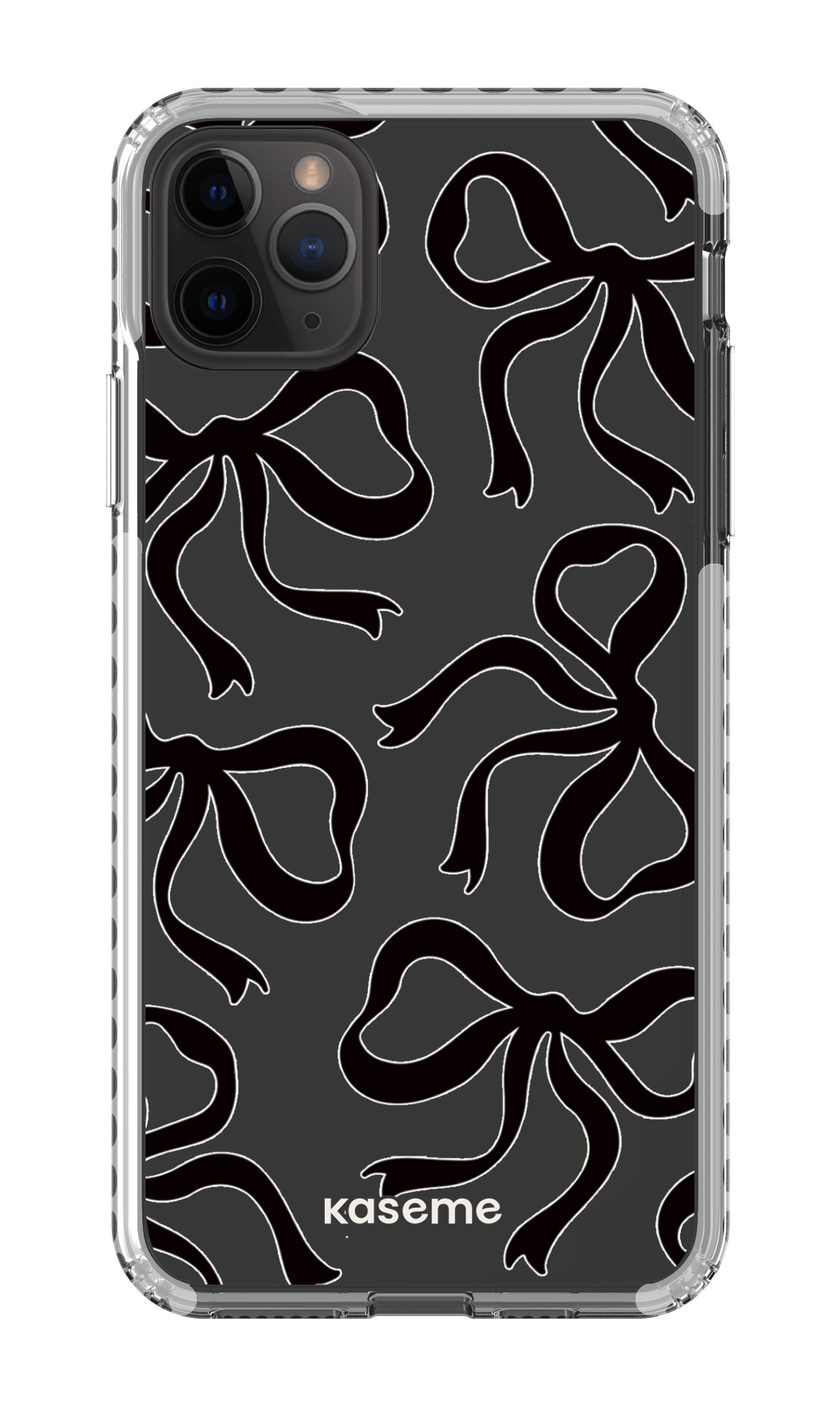iPhone 11 Pro Max Clear Case - White Lace Black Clear Case -