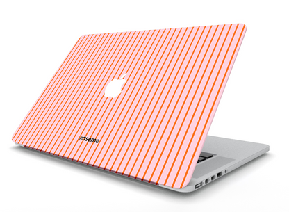 Dolce Striscia MacBook Skin