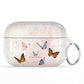 Soarin AirPods Case